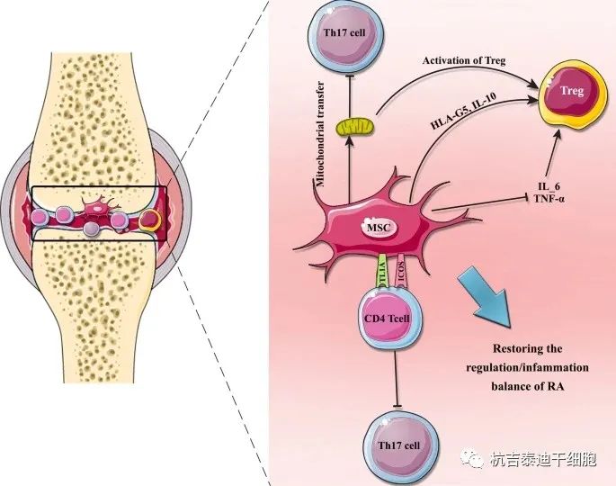 干細(xì)胞治療類風(fēng)濕關(guān)節(jié)炎的機(jī)制