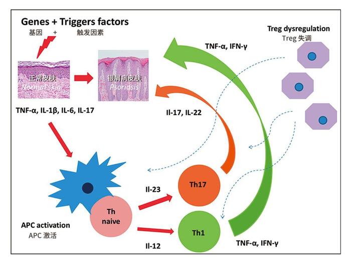 干細胞移植治療銀屑病的作用示意圖