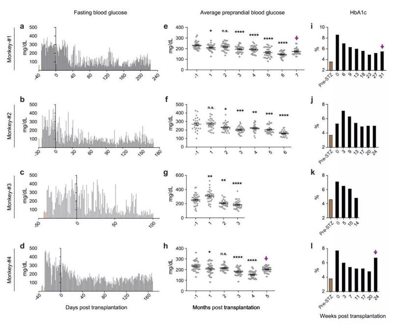 人多能干細(xì)胞分化的胰島細(xì)胞移植入糖尿病猴模型有效改善其血糖控制