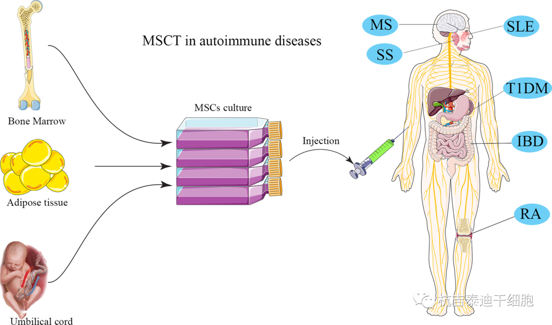 干細(xì)胞移植治療自身免疫性疾病的臨床應(yīng)用