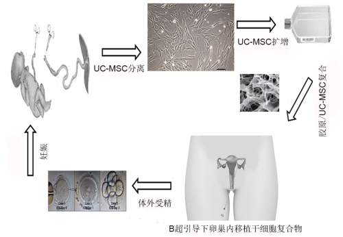 干細(xì)胞治療卵巢早衰的過程