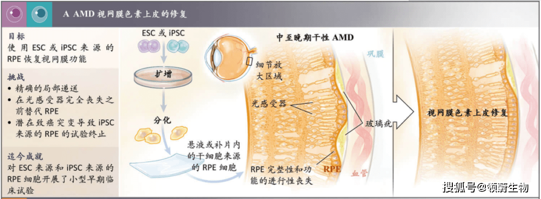 視網(wǎng)膜色素上皮的修復(fù)