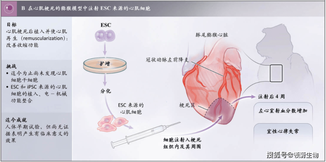 干細(xì)胞治療心肌梗死動物