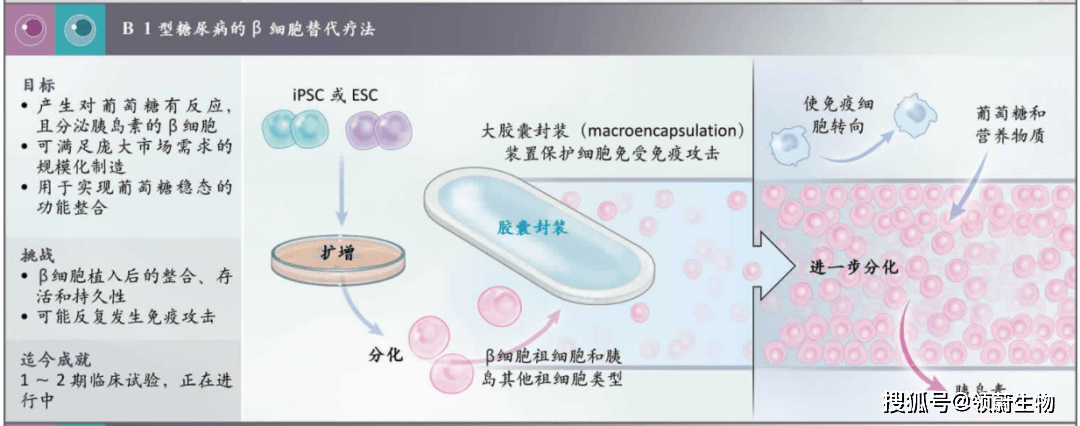 糖尿病的胰島β細(xì)胞替代療法