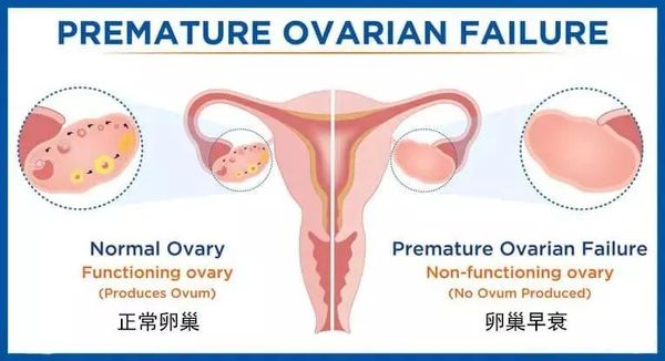 正常卵巢与卵巢早衰对比图