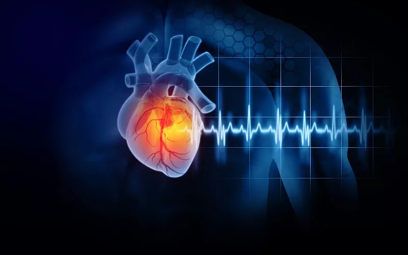 心脏病发作和心脏病三维演示