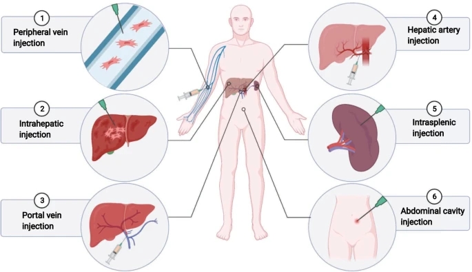 间充质干细胞移植治疗肝病的各种途径。动物实验和临床试验中MSC注射途径概述
