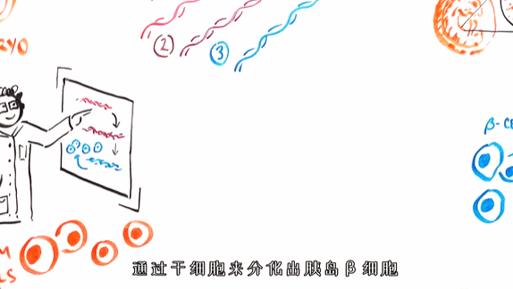 干细胞治疗糖尿病机理原理